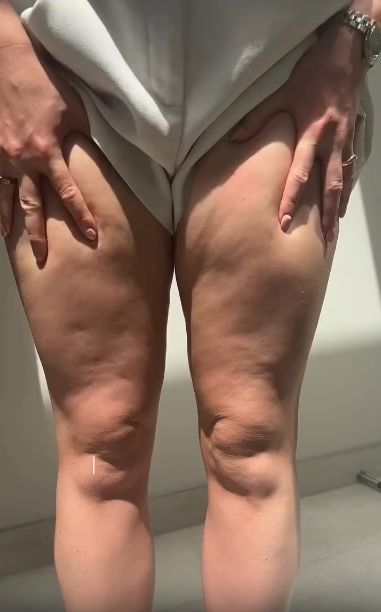 Après